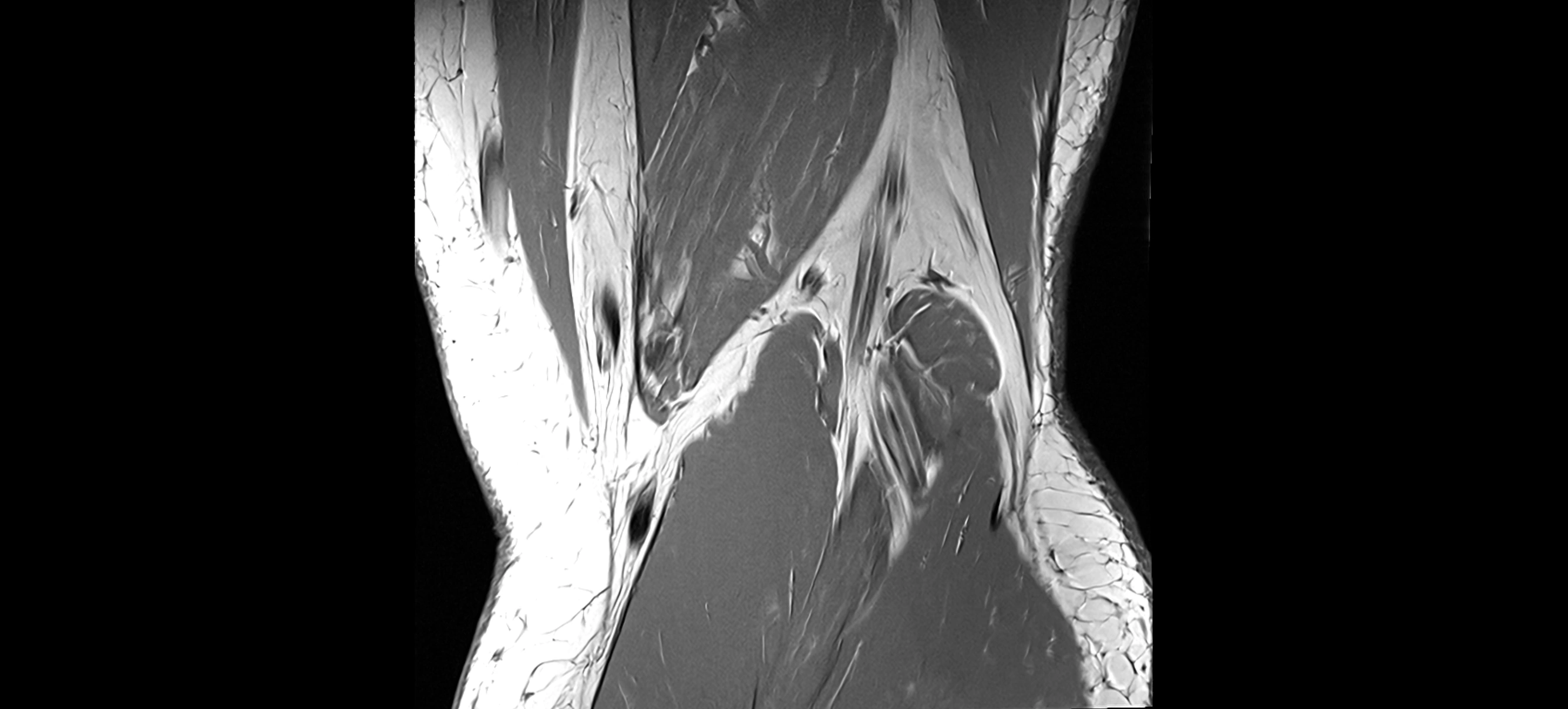 MRI coronal  ligaments cross sectional anatomy 3T  radiology  image-img-04001-00037.webp